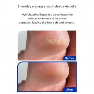 3W CLINIC Vaseline Collagen Foot Cream 150ml