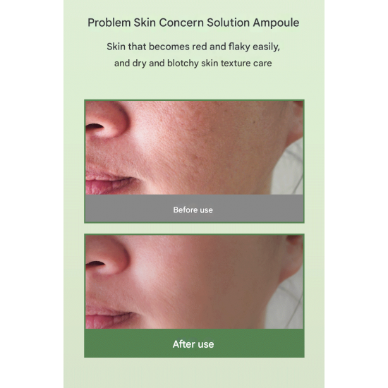 3w Clinic Cica & Hyaluronic Calming Ampoule 50ml