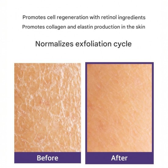 3W CLINIC LAB Collaen & Retinol Blemish Mask Pack