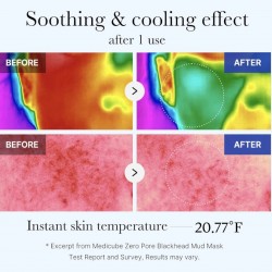 Medicube Zero Pore Blackhead Mud Facial Mask 100g