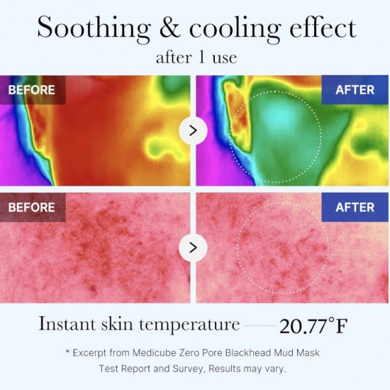 Medicube Zero Pore Blackhead Mud Facial Mask 100g