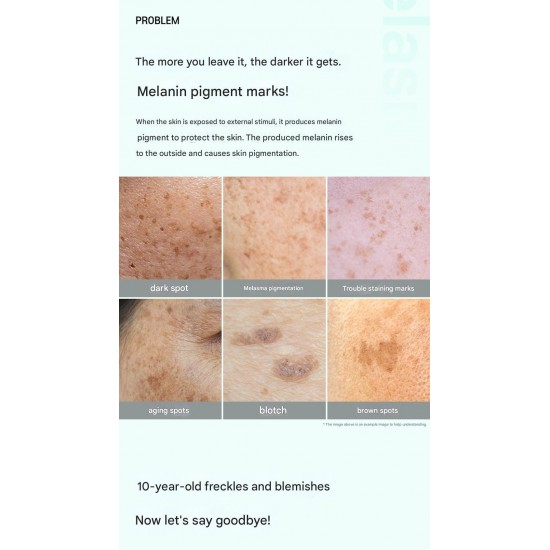 CARENEL Anti-Melasma Cica Intensive Serum