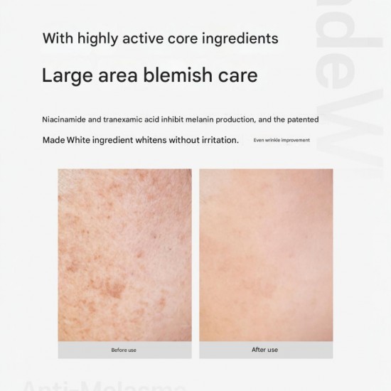 CARENEL Anti-Melasma Cica Intensive Serum