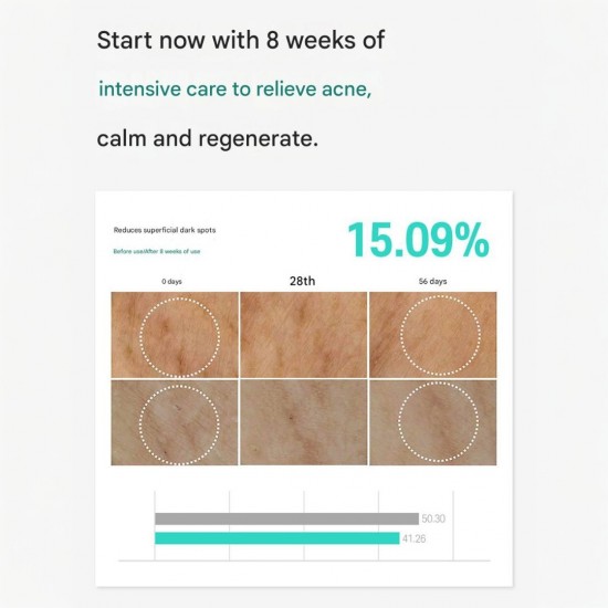 CARENEL Anti-Melasma Cica Intensive Serum