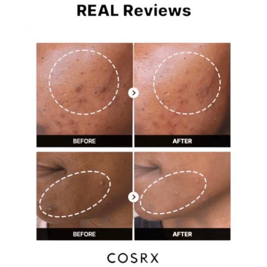 Cosrx The Alpha Arbutin 2 Discoloration Care Serum 50ml