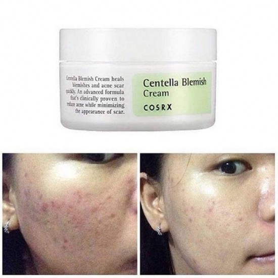 Cosrx Centella Blemish Cream 30ml