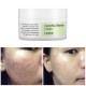 Cosrx Centella Blemish Cream 30ml
