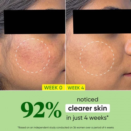 Dot & Key Cica Calming Oil Free Moisturizer for Acne Prone Skin 60ml