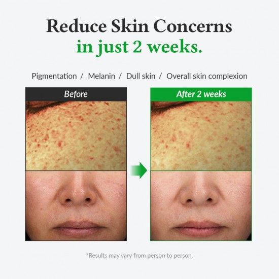 Dr.Althea Gentle Vitamin C Serum 30ml