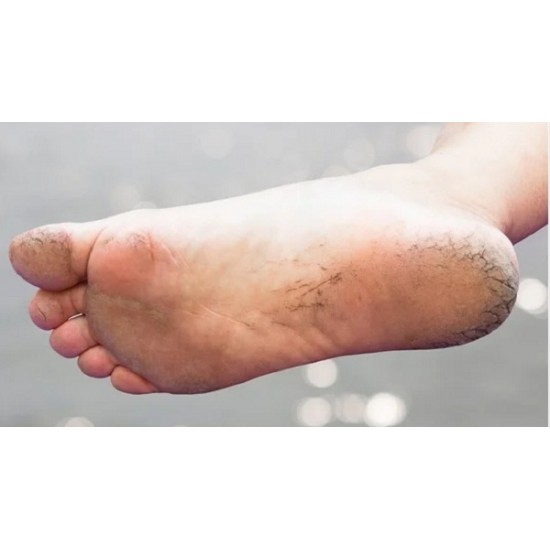 3W Clinic Enrich Foot Treatment Cream 3W Clinic Enrich Foot Treatment Cream