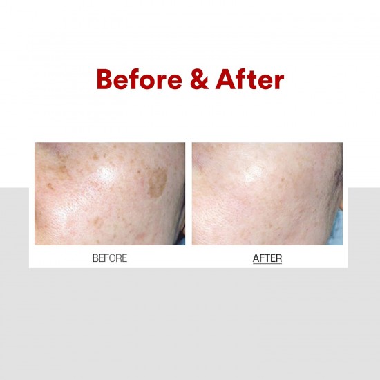 MediPeel Melanon X Cream 30ml