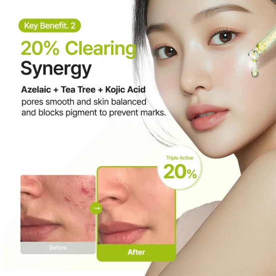 Purito Azelaic Acid 10% + Kojic + Tea Tree Serum 30ml
