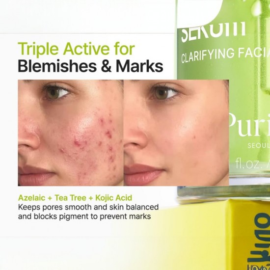 Purito Azelaic Acid 10% + Kojic + Tea Tree Serum 30ml
