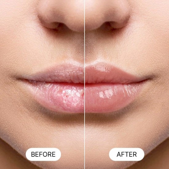 Tenzero Essential Lip Balm Honey Vita C 9g