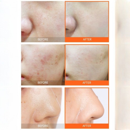 TheYEON Vita7 Energy Peeling Gel 100ml