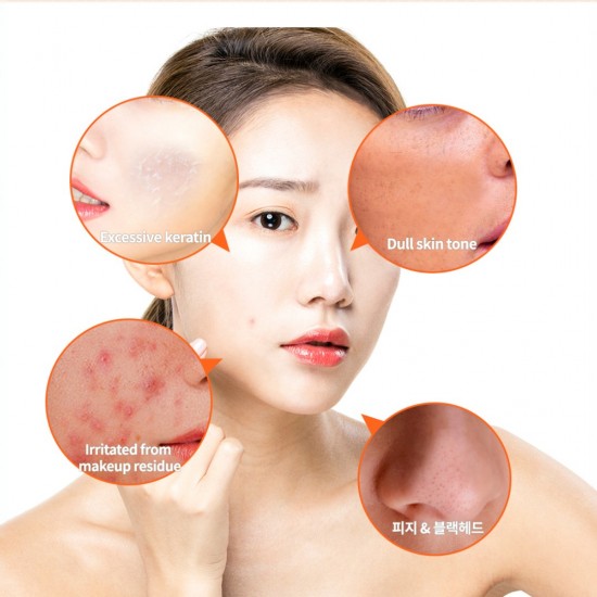 TheYEON Vita7 Energy Peeling Gel 100ml