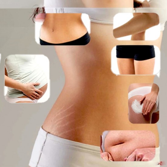 Derma House Stretch Care Cream 180ml