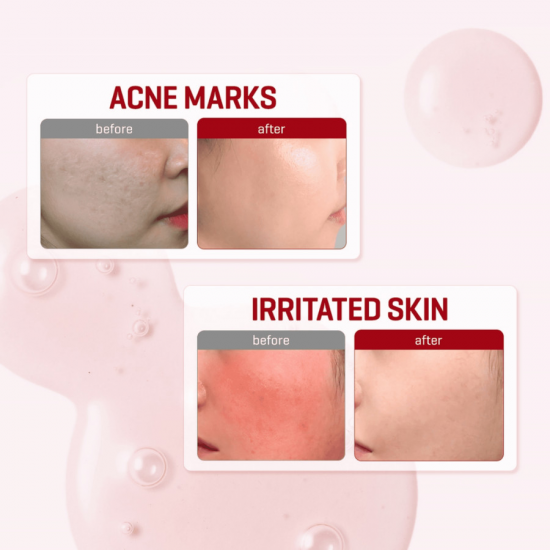 Some By Mi Snail Truecica Miracle Repair Serum